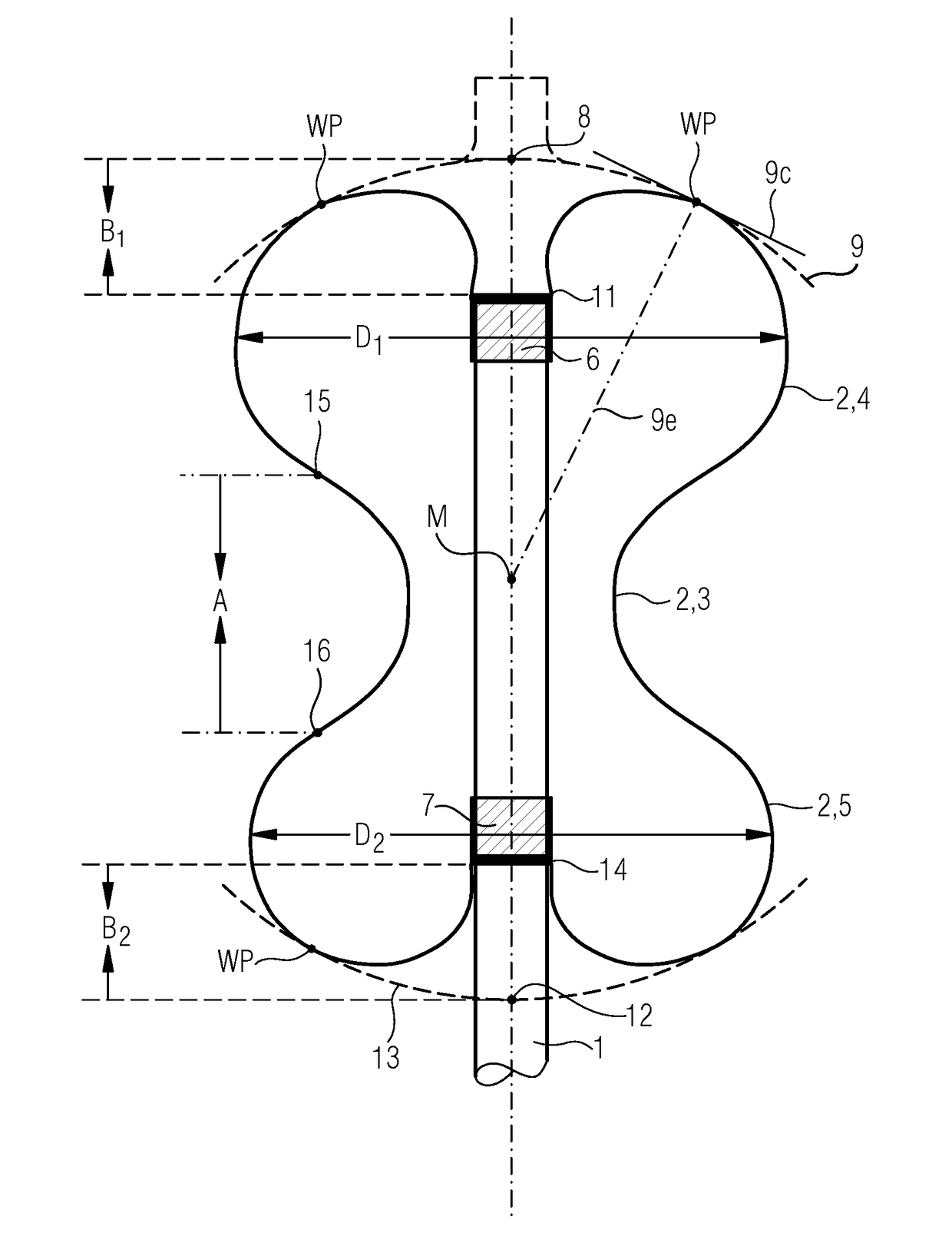 Trans-anal inflow catheter for intermittently triggering a reflex-coordinated defecation