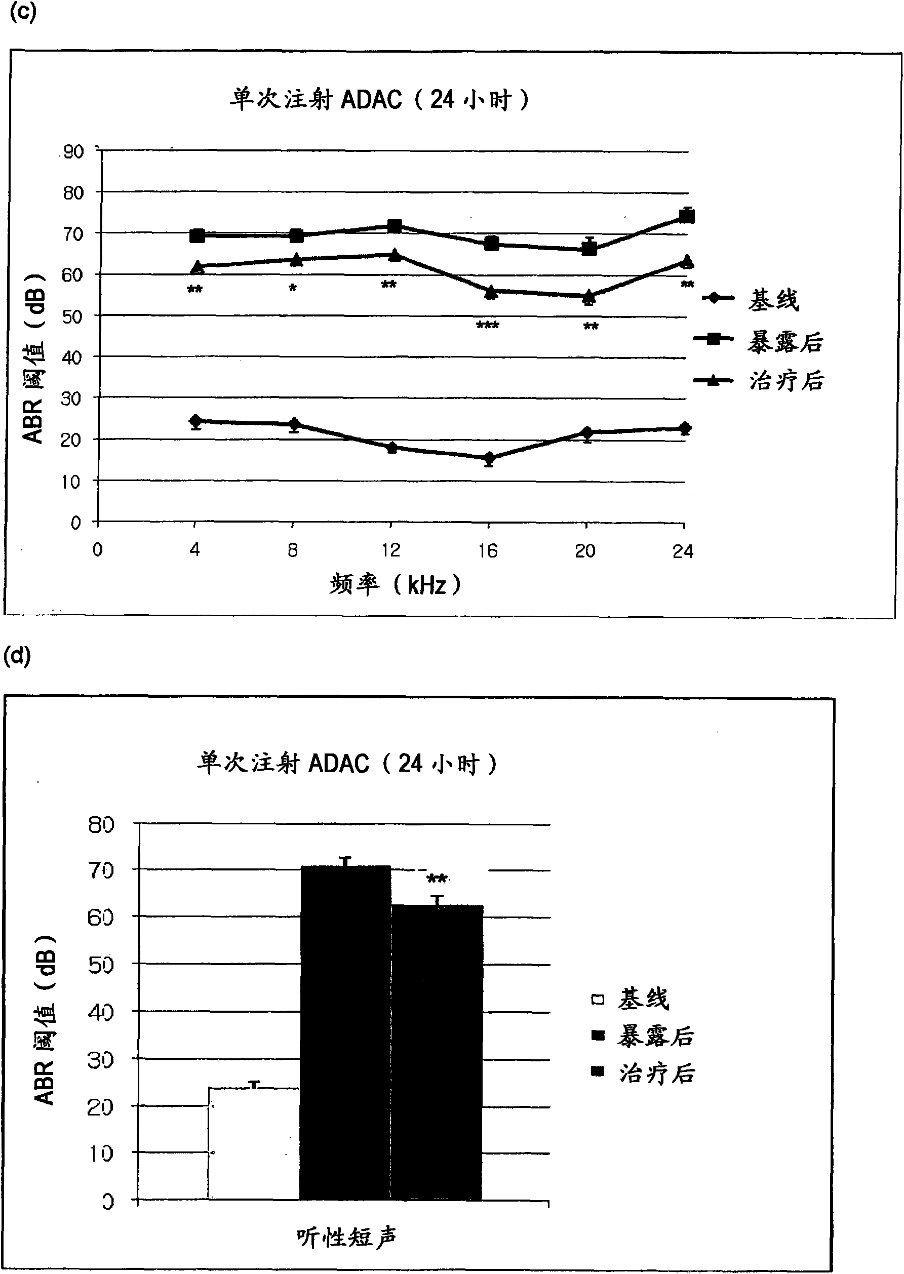 The treatment of hearing loss