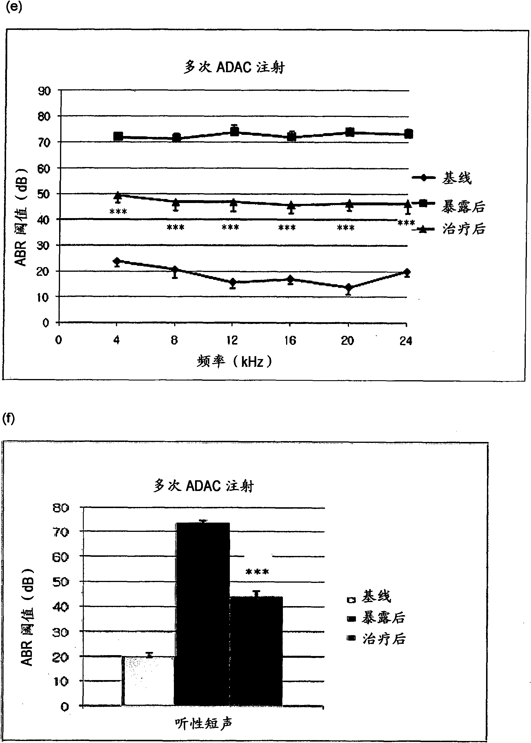 The treatment of hearing loss