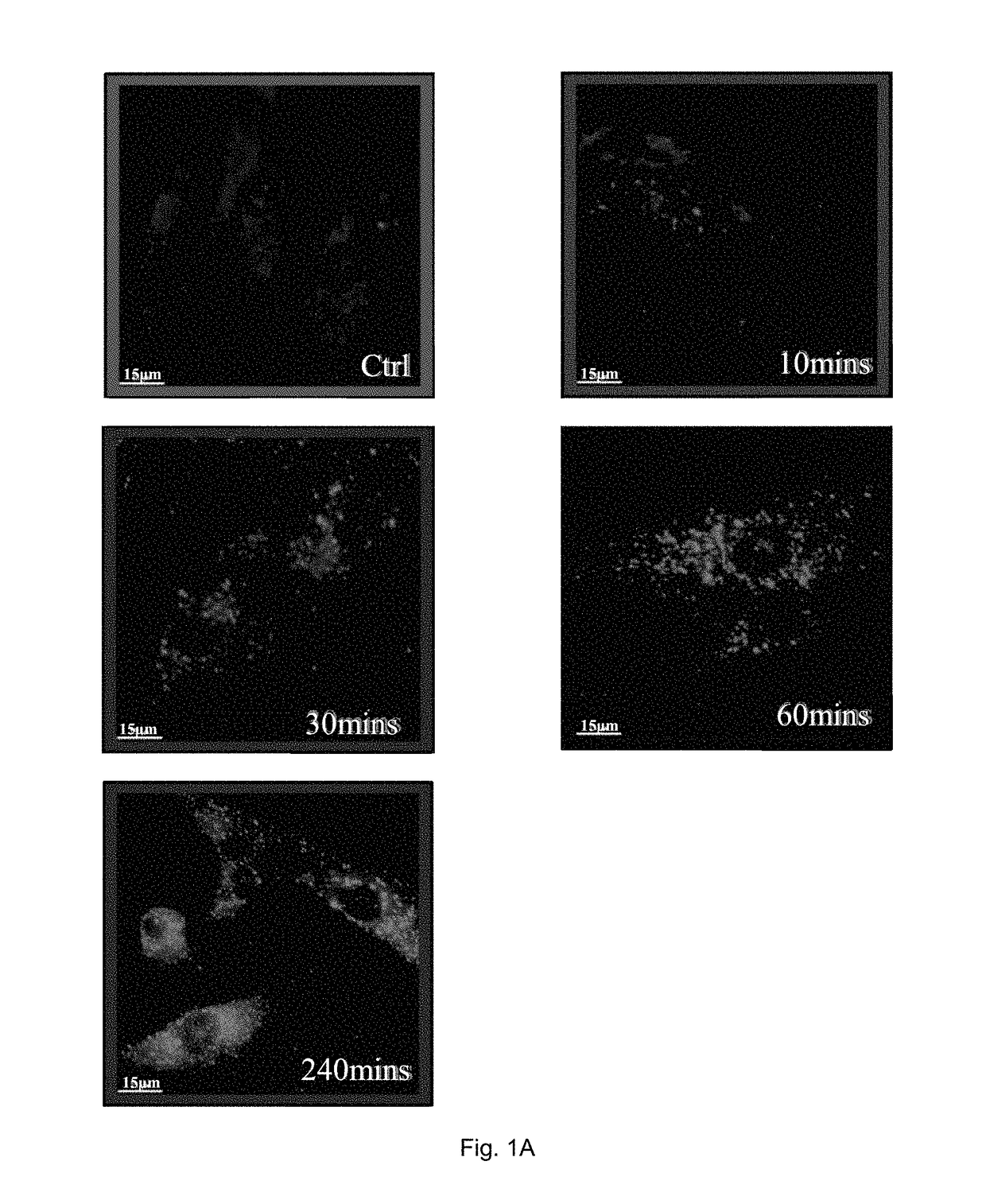 Method of treating refractory rheumatoid arthritis