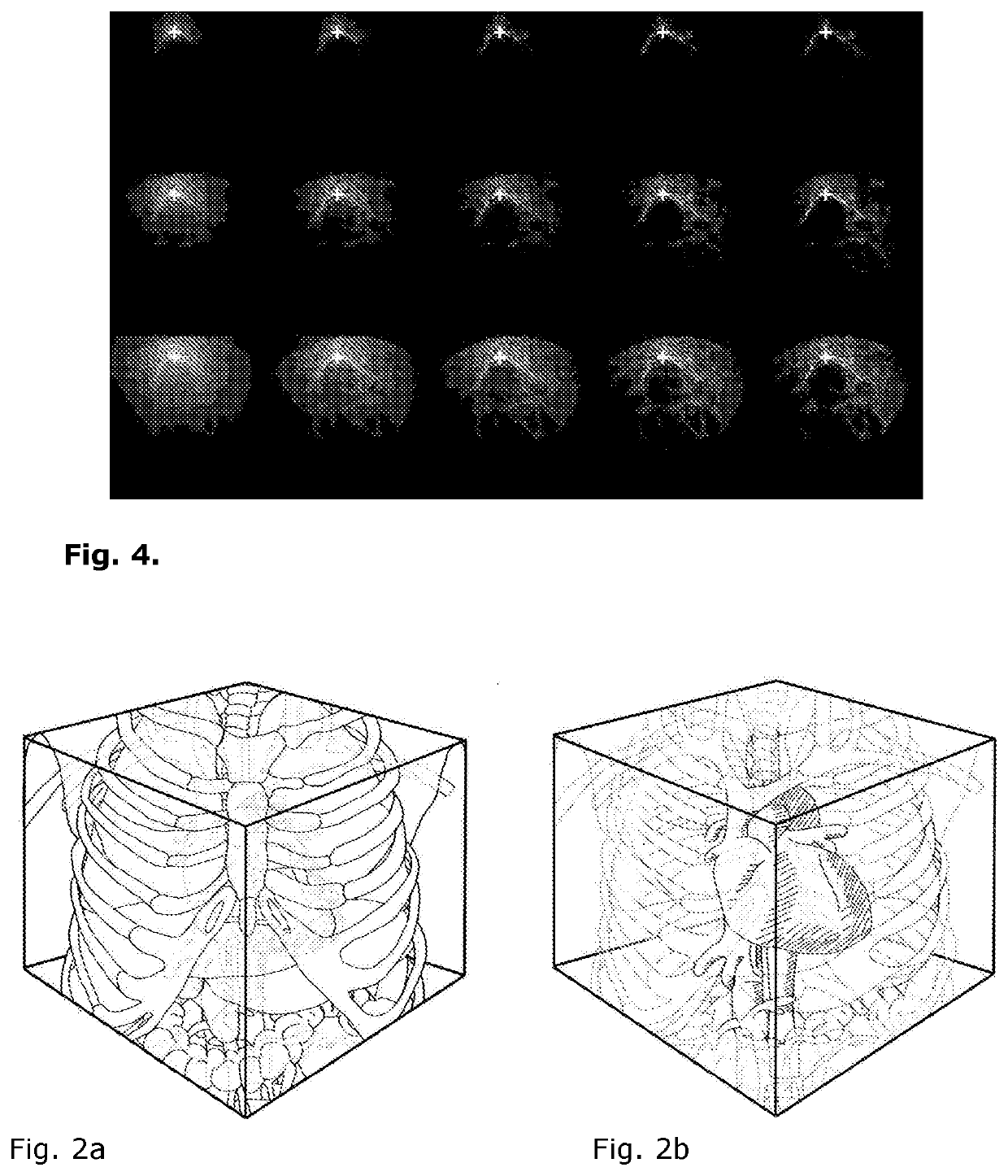 Computer implemented method and system for navigation and display of 3D image data