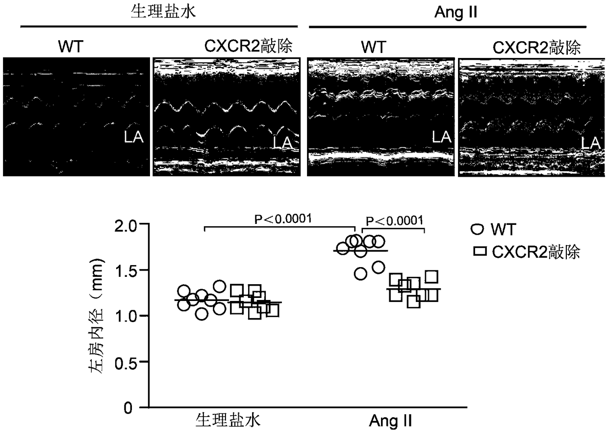 Application of CXCR2 gene in heart-related diseases