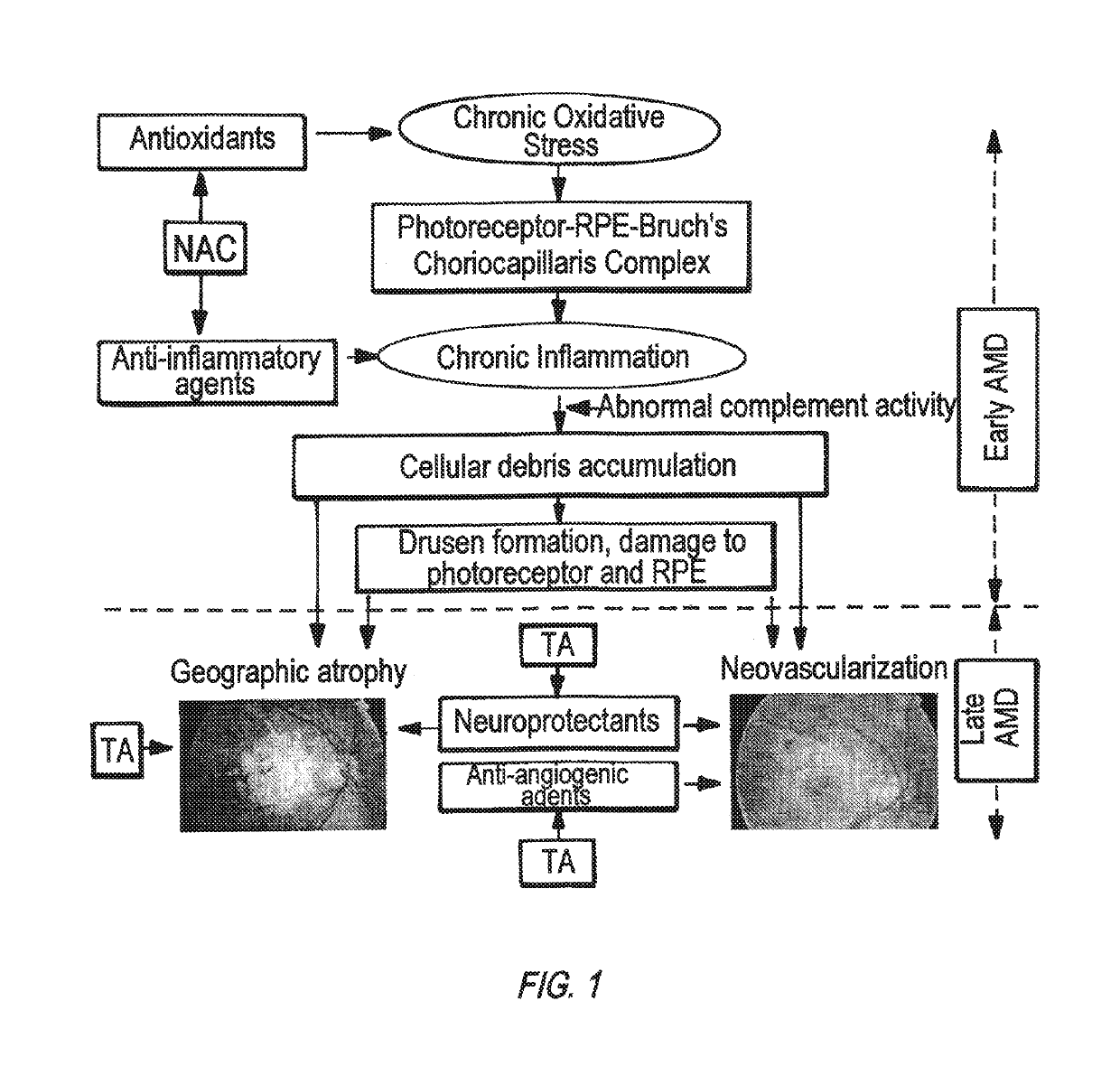 Dendrimer compositions and their use in treatment of diseases of the eye