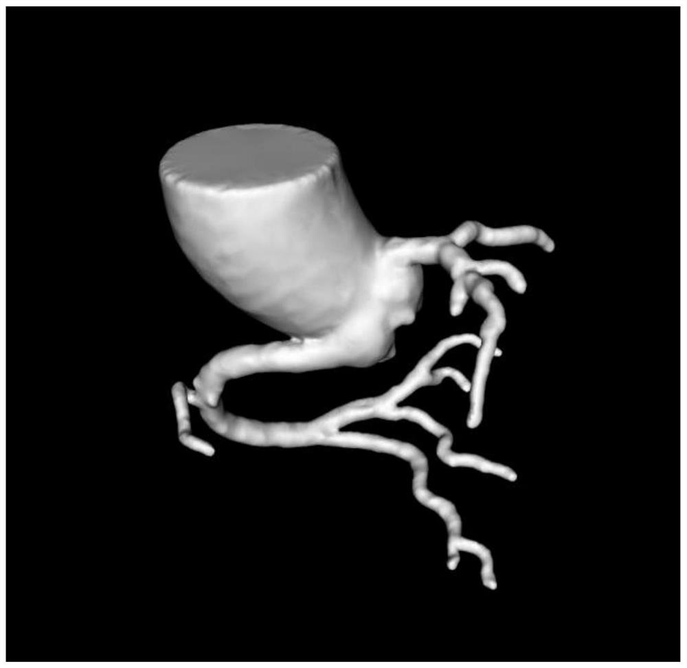 A method for extracting coronary artery centerline