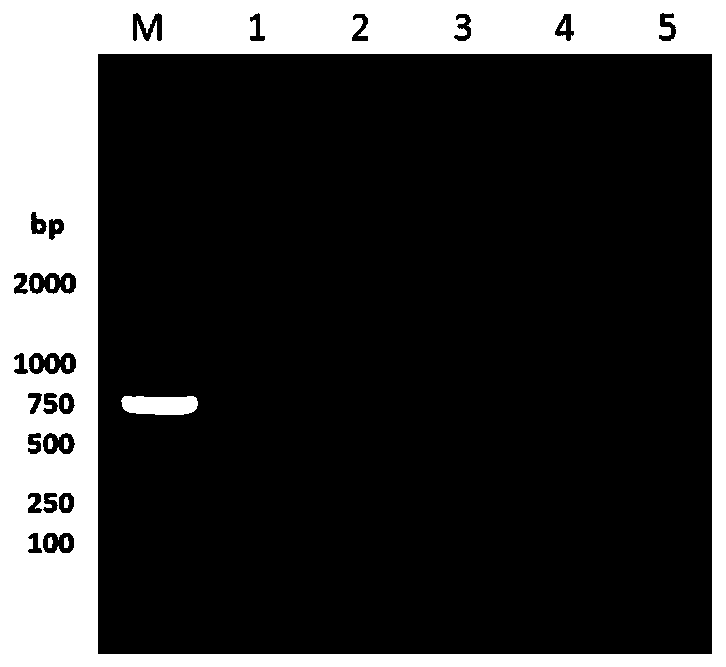 RT-LAMP (reverse transcription loop-mediated isothermal amplification) detection kit for maize yellow mosaic viruses and application of kit