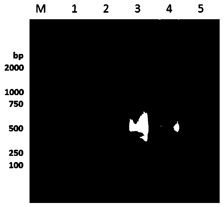 RT-LAMP (reverse transcription loop-mediated isothermal amplification) detection kit for maize yellow mosaic viruses and application of kit