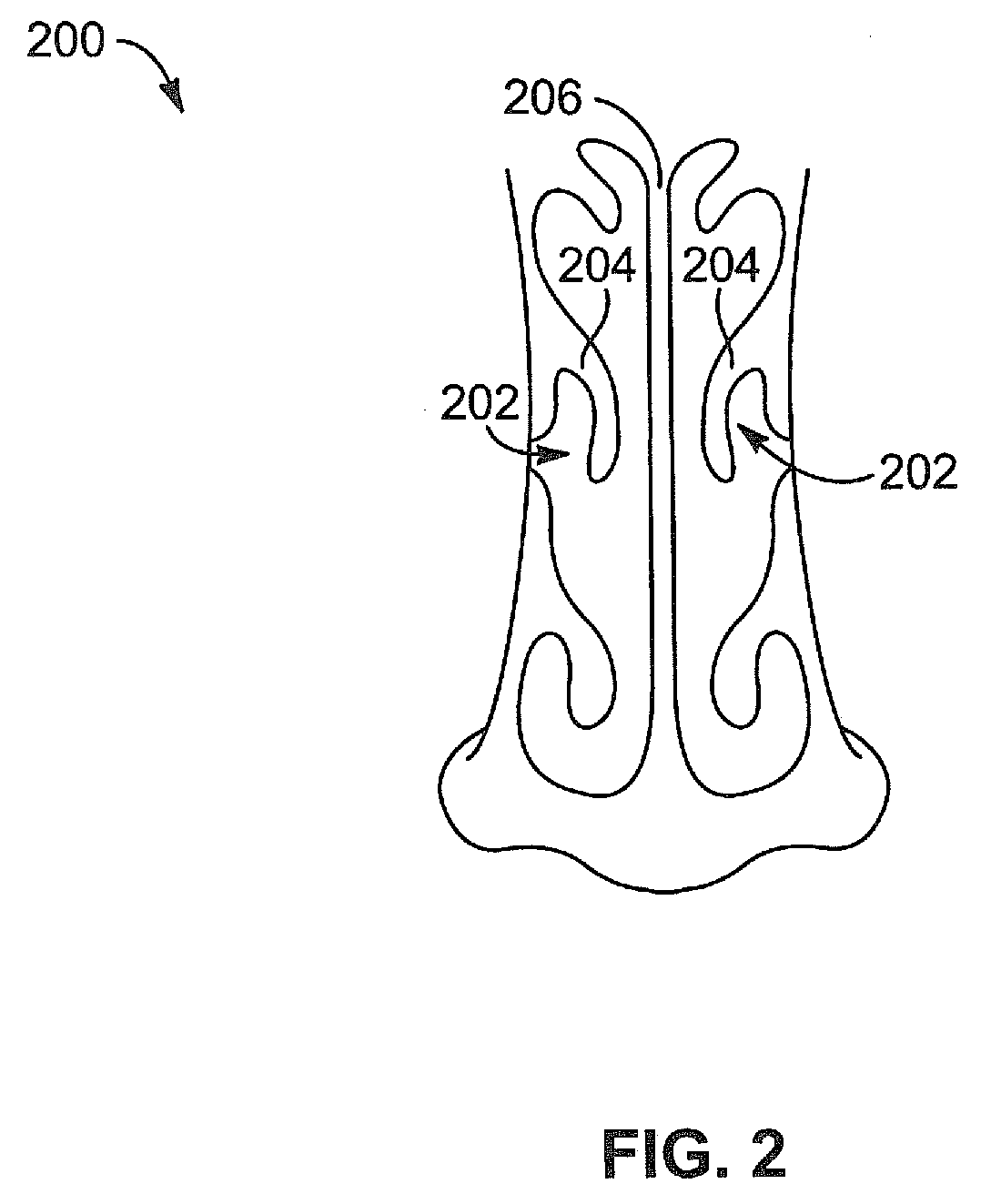 Apparatus, system, and method for middle turbinate medializer