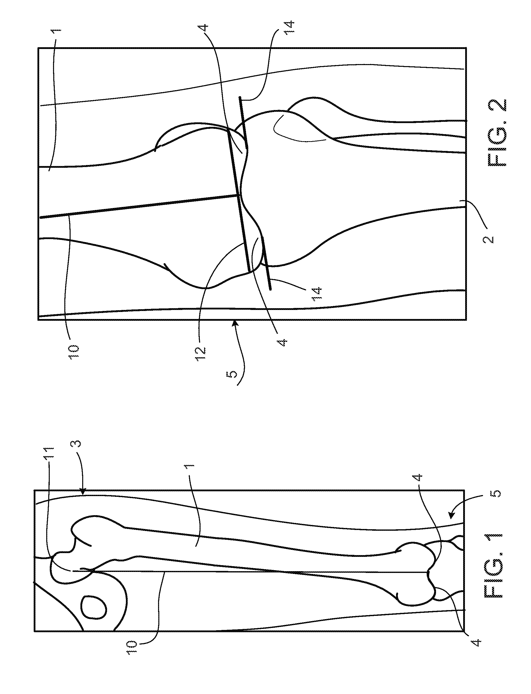 Alignment devices and methods