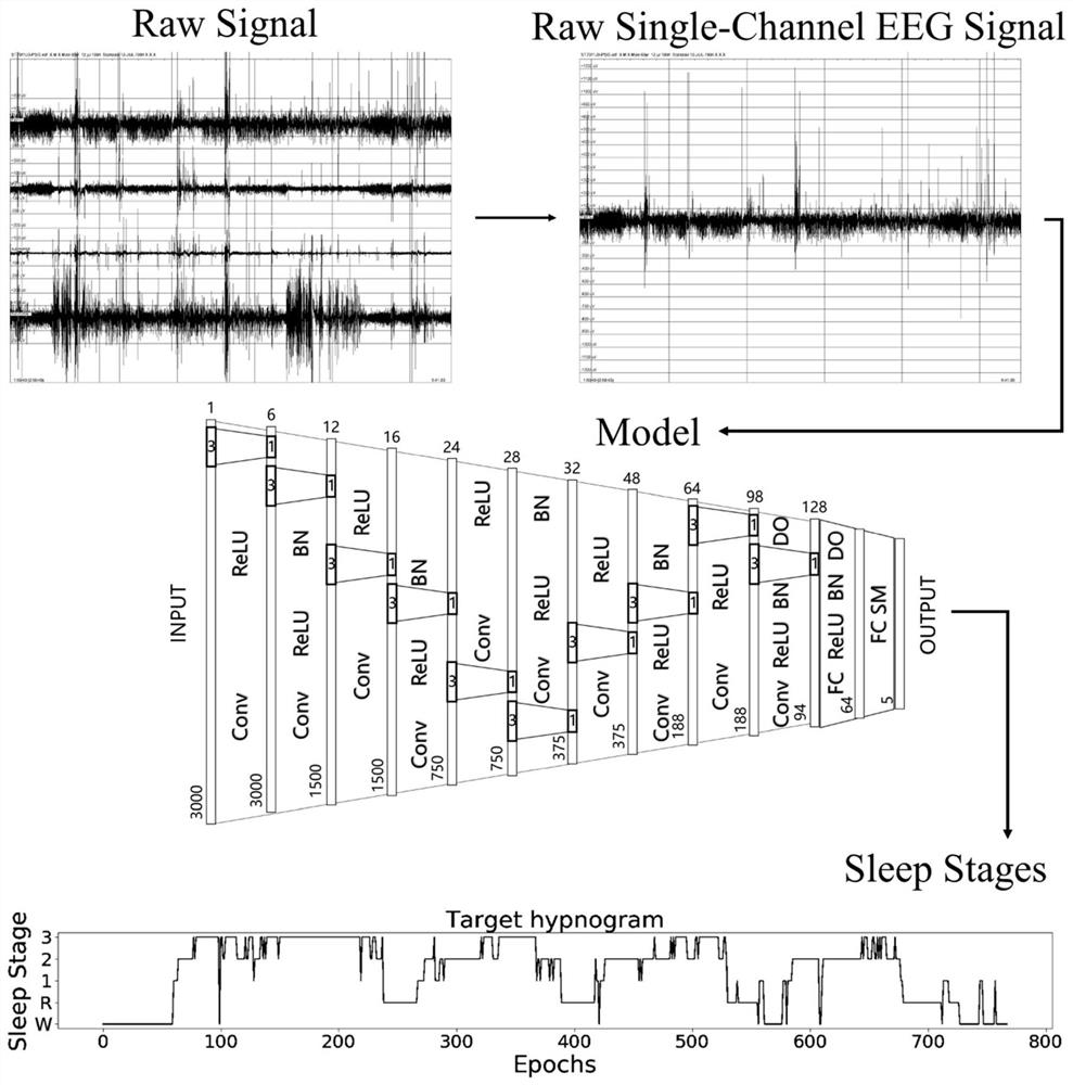 Sleep staging method based on deep learning