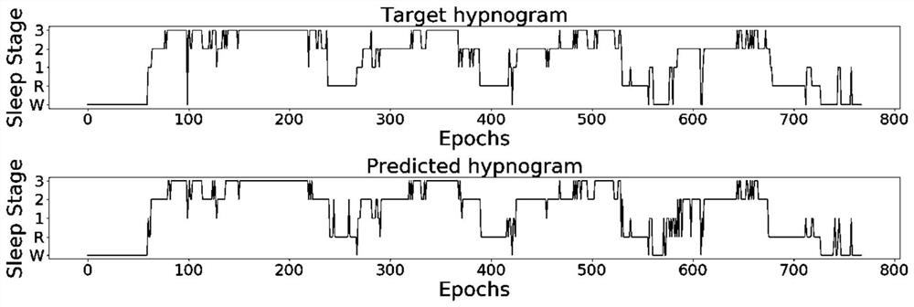 Sleep staging method based on deep learning