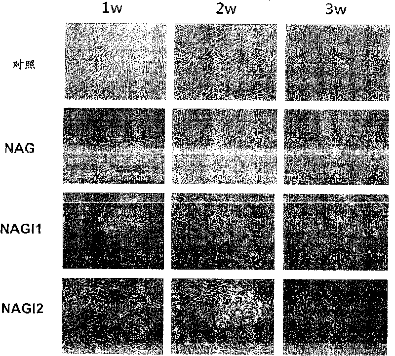 Method for the differentiation of human adult stem cells into insulin-secreting cells