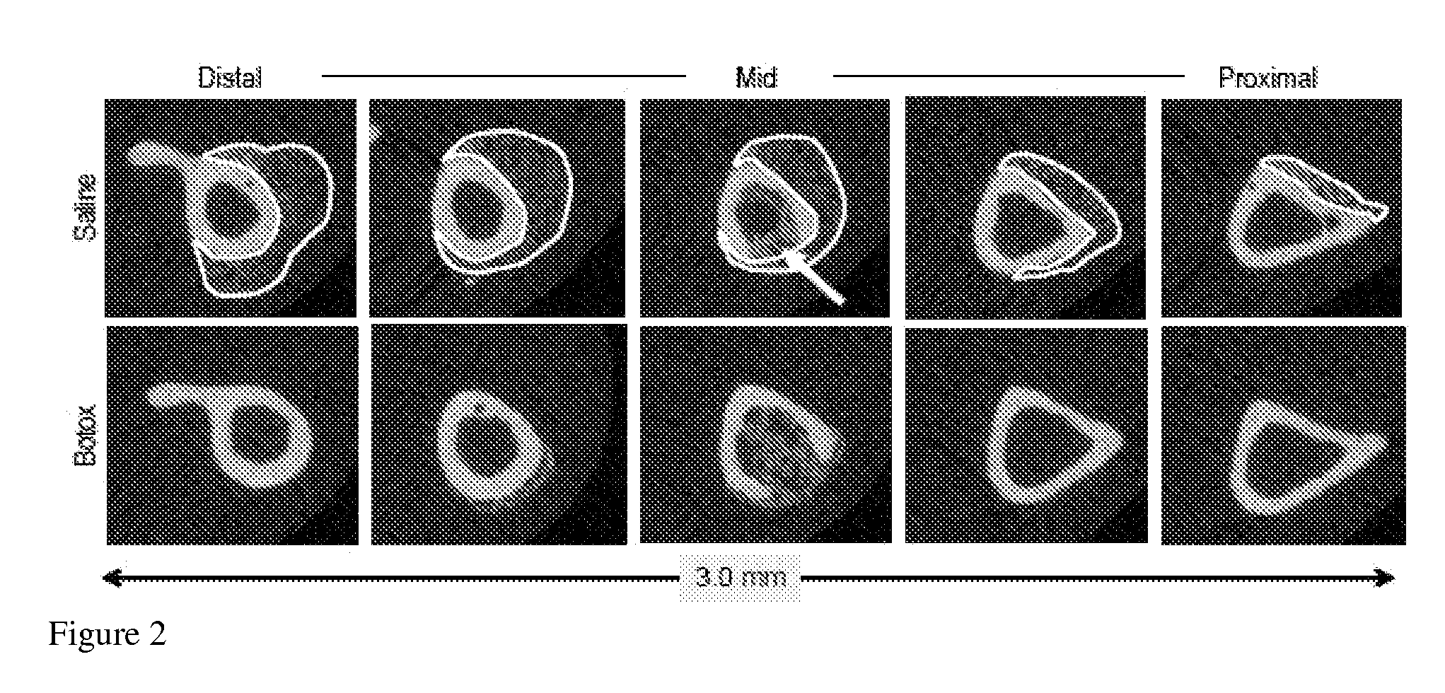 Inhibition of pathological bone formation