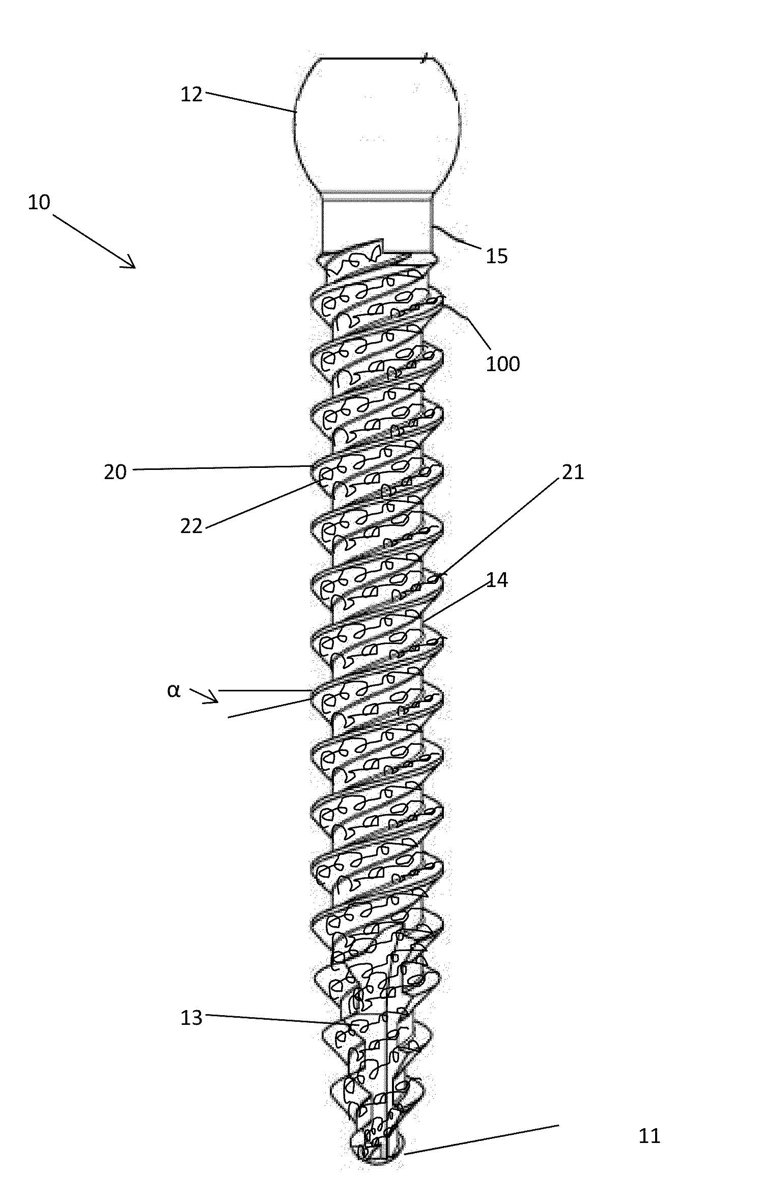 Bone screw fastener