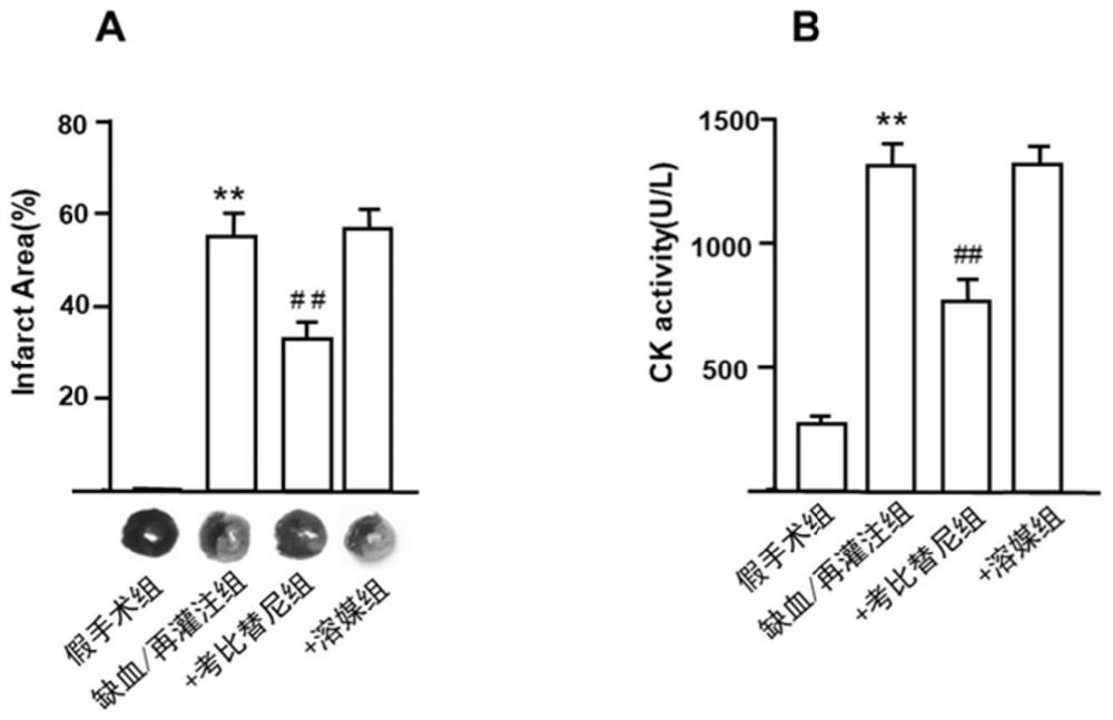 Application of cobimetinib in preparation of medicine for treating ischemia/reperfusion injury and cell protection medicine