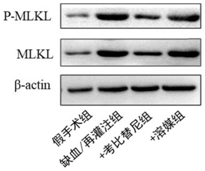 Application of cobimetinib in preparation of medicine for treating ischemia/reperfusion injury and cell protection medicine