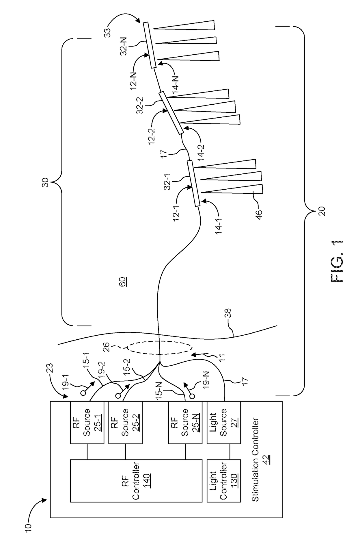 Implantable Optical Stimulation and Detection Leads for Nervous Tissue