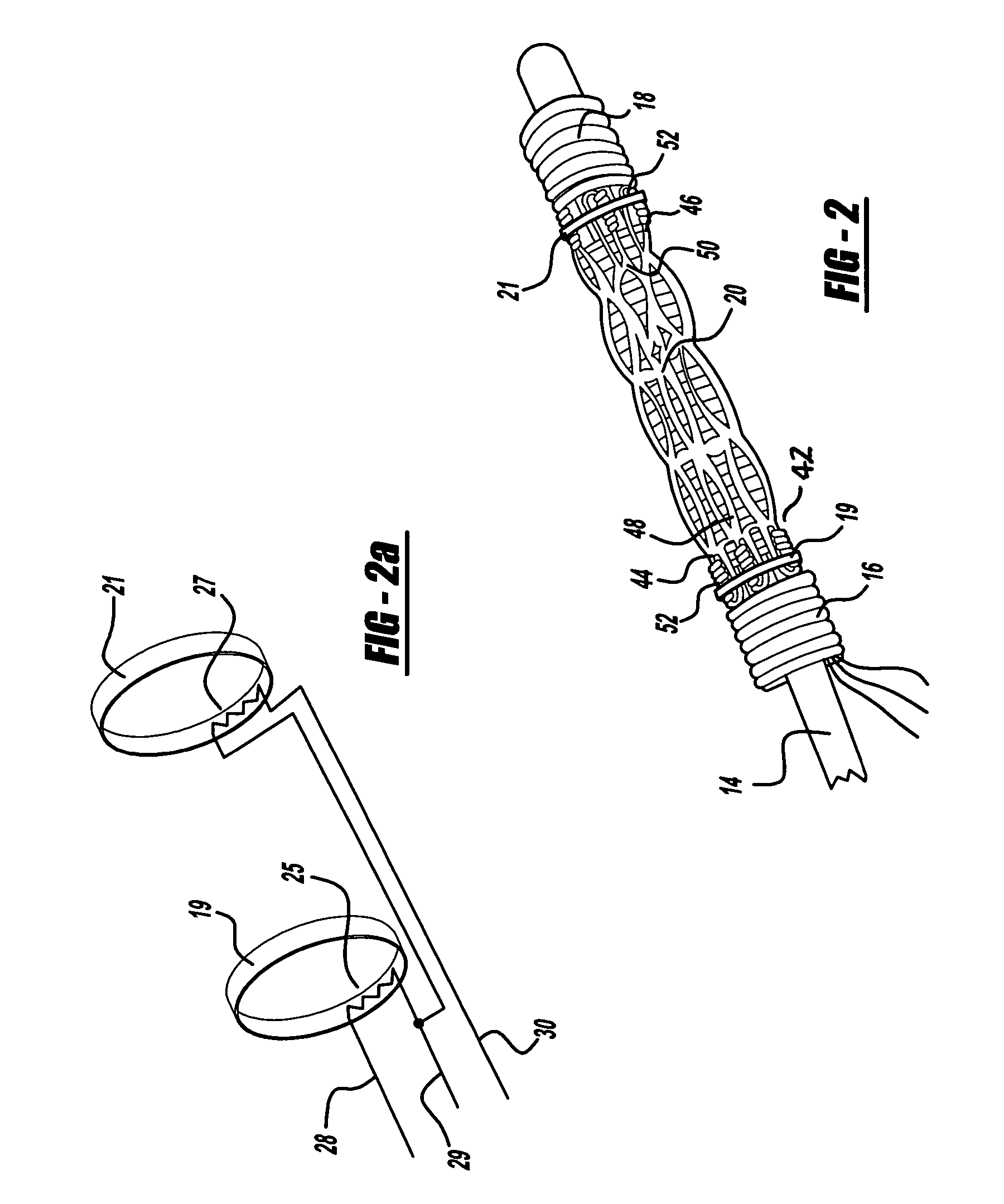 Self-expanding stent and stent delivery system for treatment of vascular disease