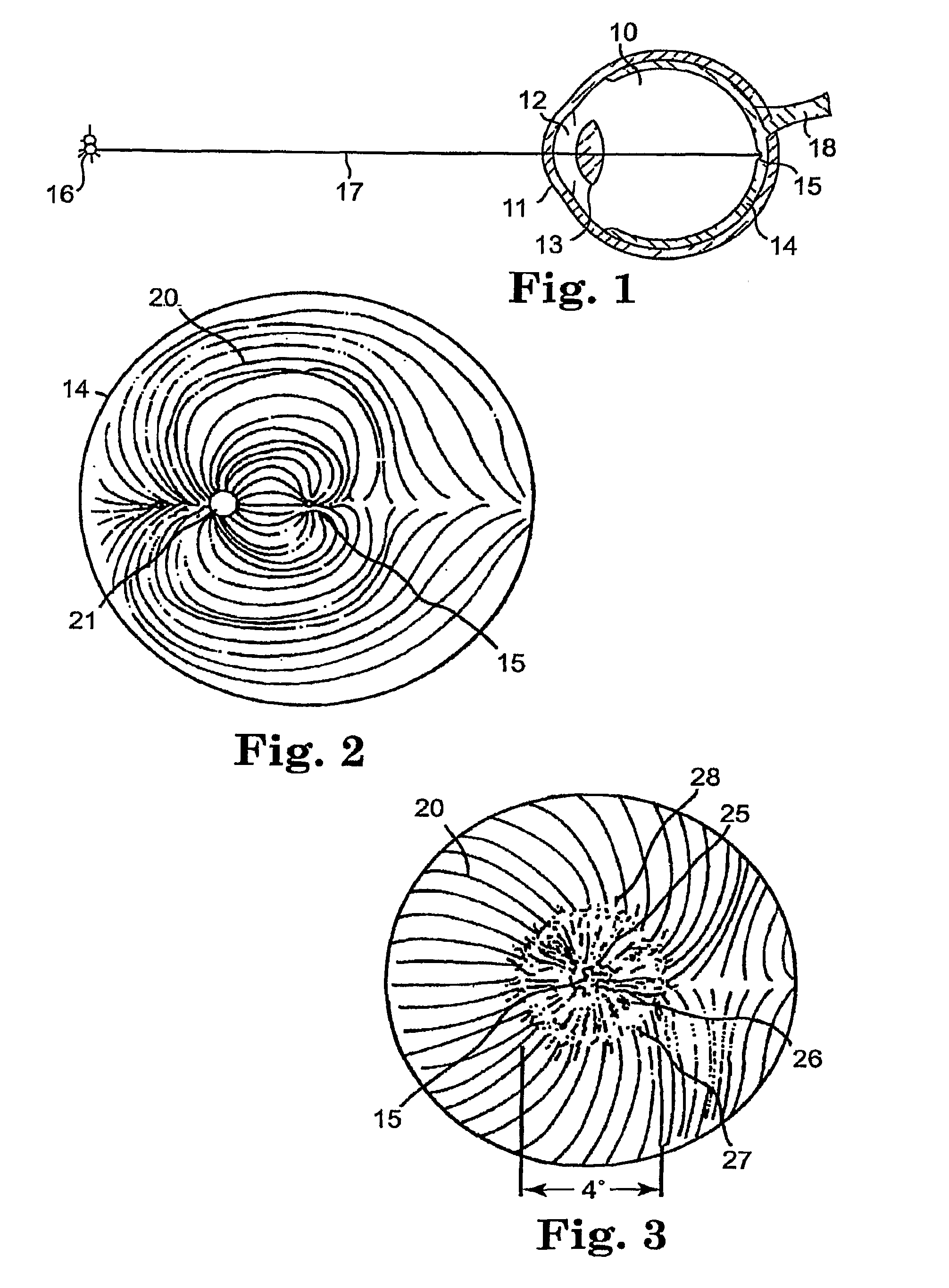 Vision screener