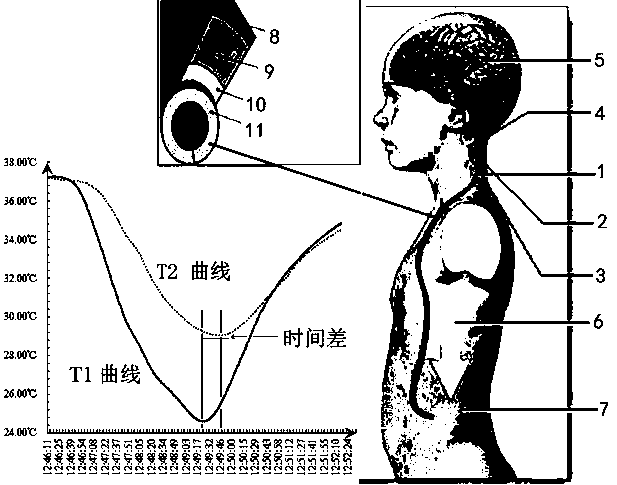 Cerebrospinal fluid shunt flow detection computing method