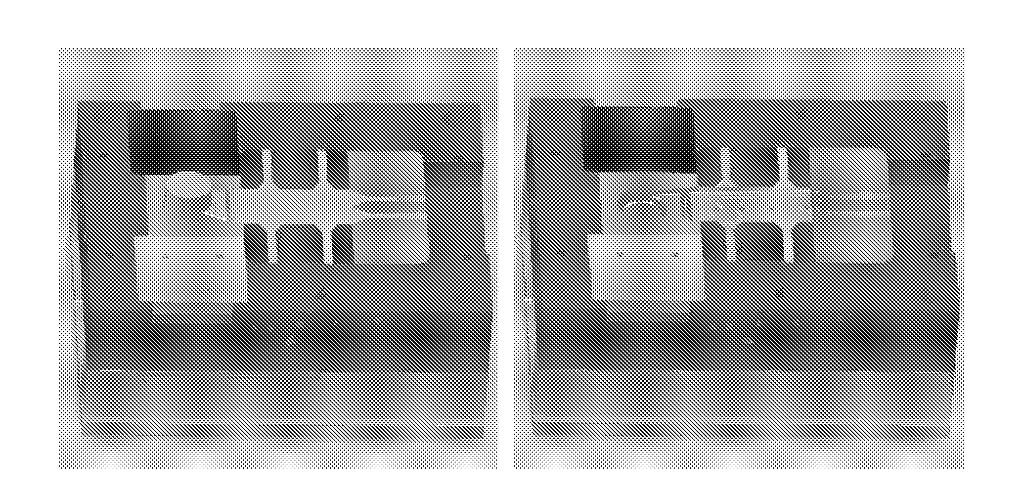 Feeding System for Semi-Solid Metal Injection