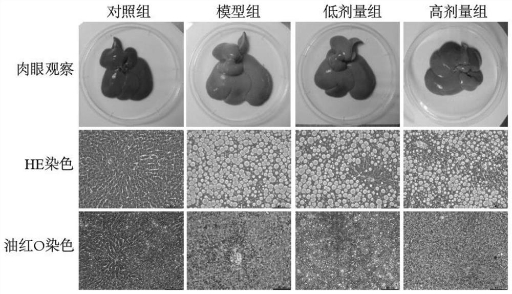 A traditional Chinese medicine composition capable of alleviating non-alcoholic steatohepatitis, its preparation method and product