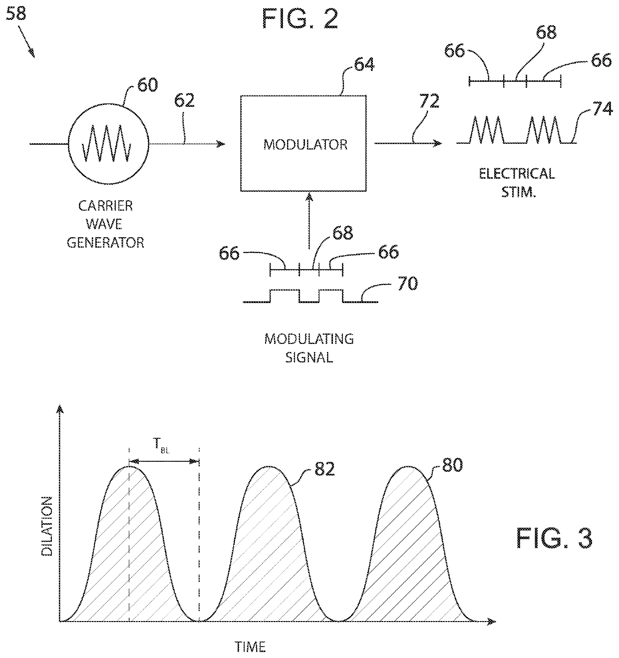 Penetration of Cerebral Spinal Fluid into the Brain Parenchyma Using Temporally Patterned Neuromodulation