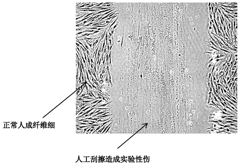 Medicine for promoting tissue cell regeneration