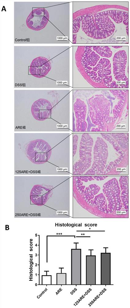 Hibiscus sabdariffa anthocyanin extract as well as preparation method and application thereof