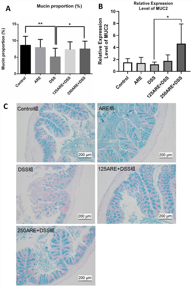 Hibiscus sabdariffa anthocyanin extract as well as preparation method and application thereof