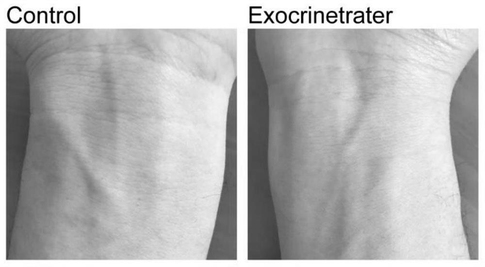 Preparation method and application of a kind of artificial exosome complex