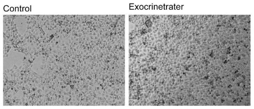 Preparation method and application of a kind of artificial exosome complex