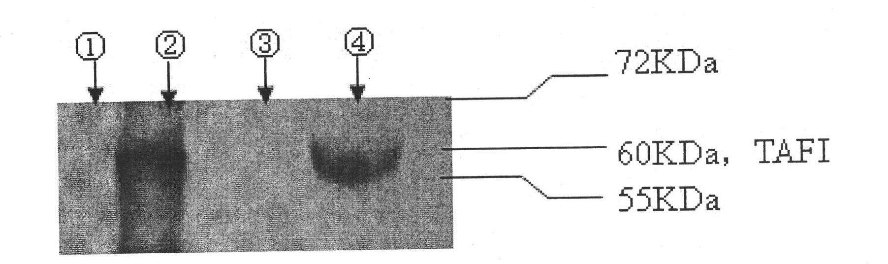 In-vitro assay method for thrombin-activatable fibrinolysis inhibitor (TAFI) content