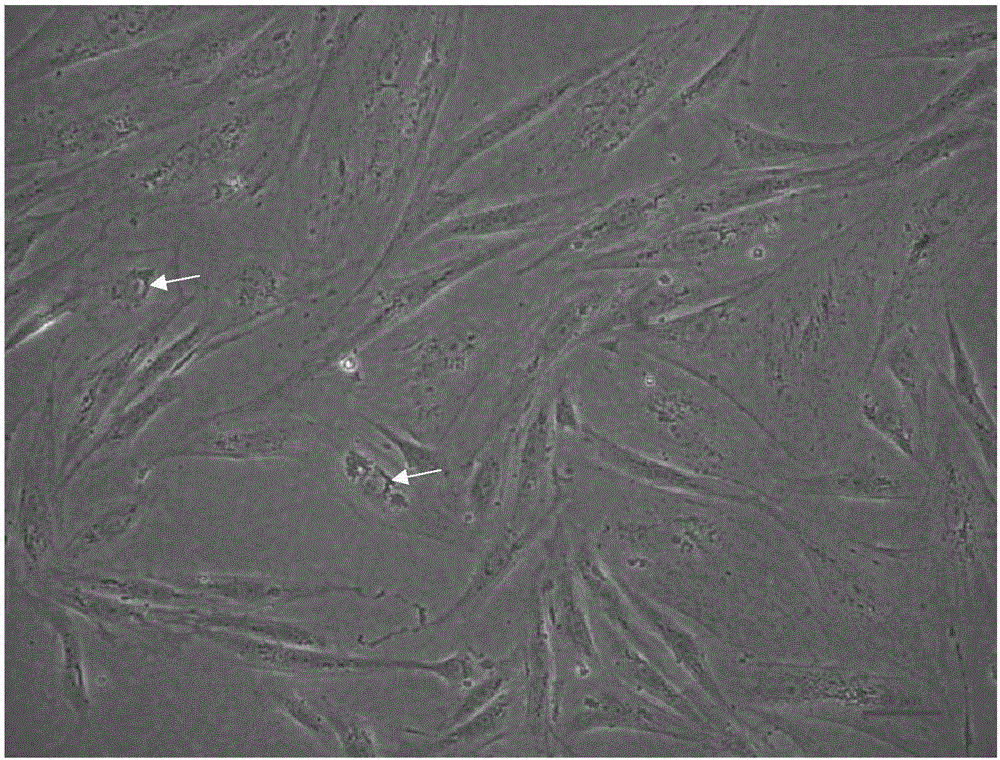 In vitro culture solution and cryopreservation solution of Ietalurus Punetaus spermatogonial stem cells, and in vitro culture and cryopreservation method