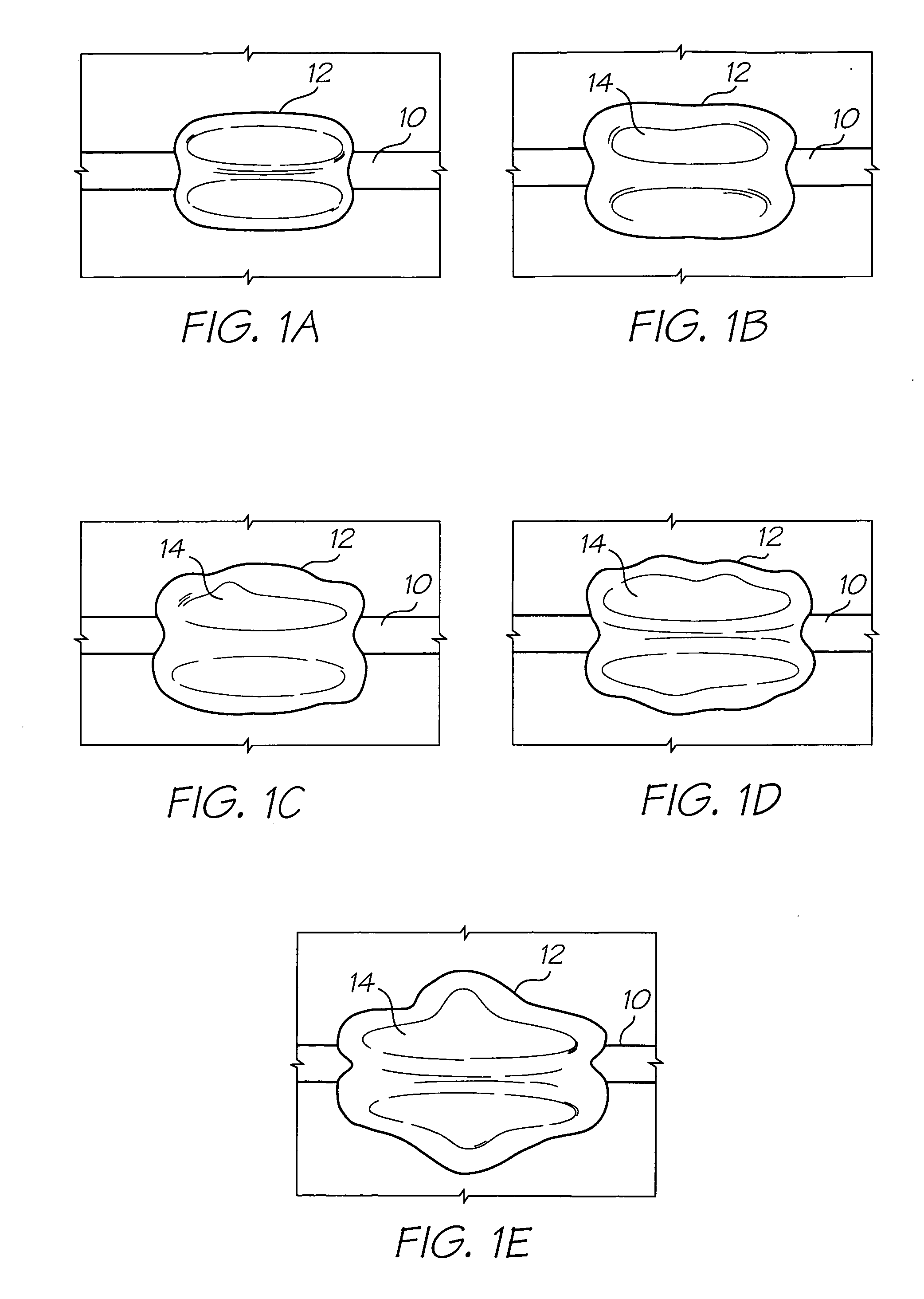 MEMS bubble generator for large stable vapor bubbles