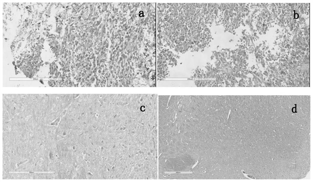 Application of combination of clostridium ghonii and tumor angiogenesis inhibitor