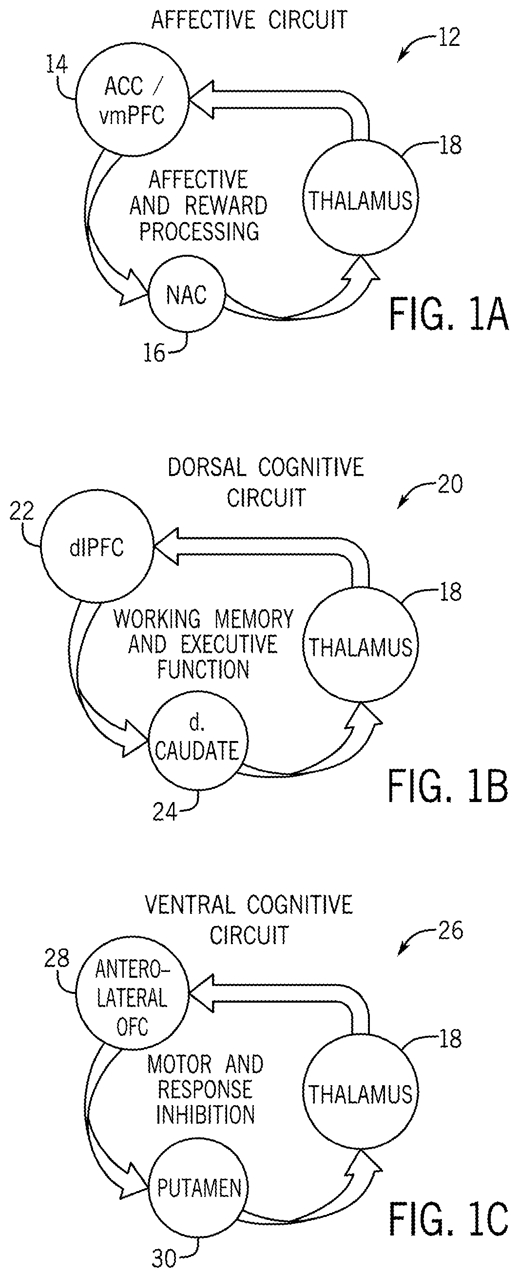 Systems and methods for treating mental and neurological disorders involving abnormally high brain connectivity