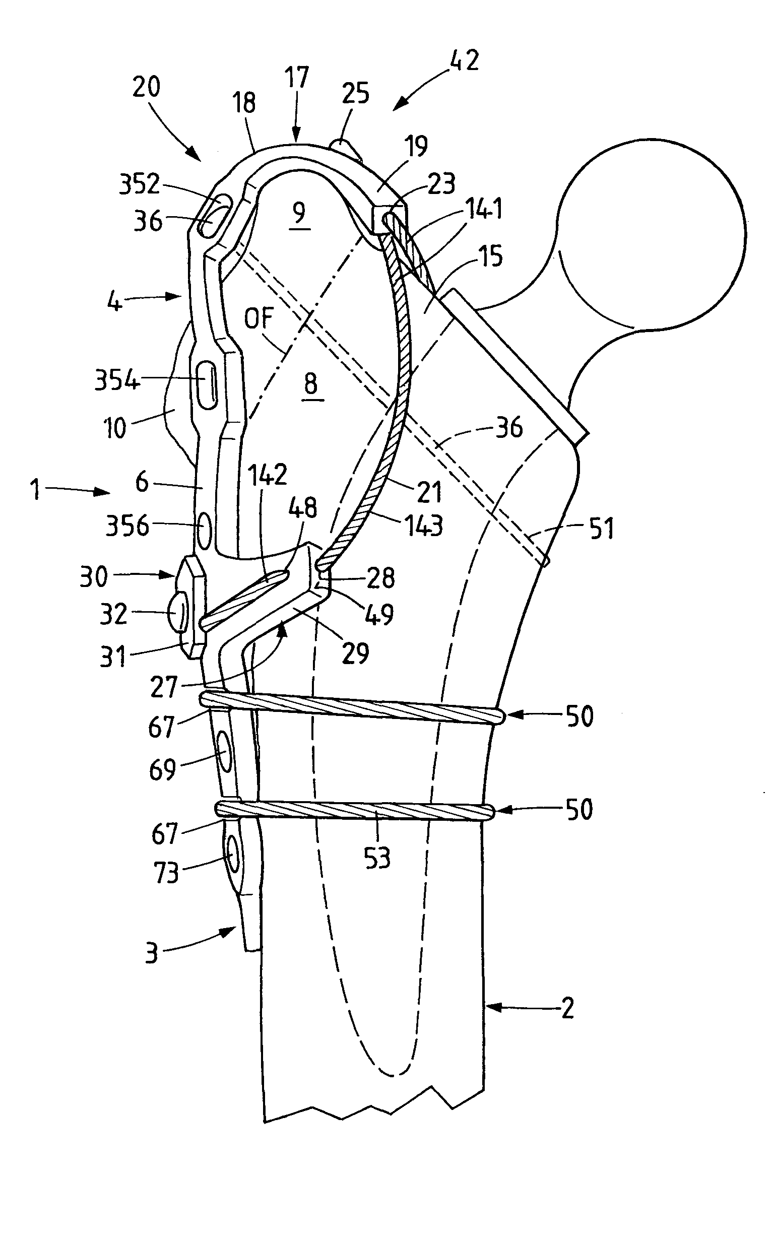 Trochanter retention plate