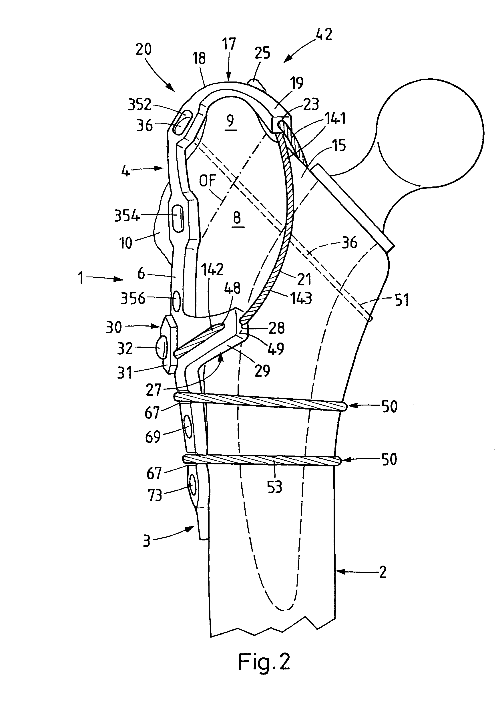 Trochanter retention plate