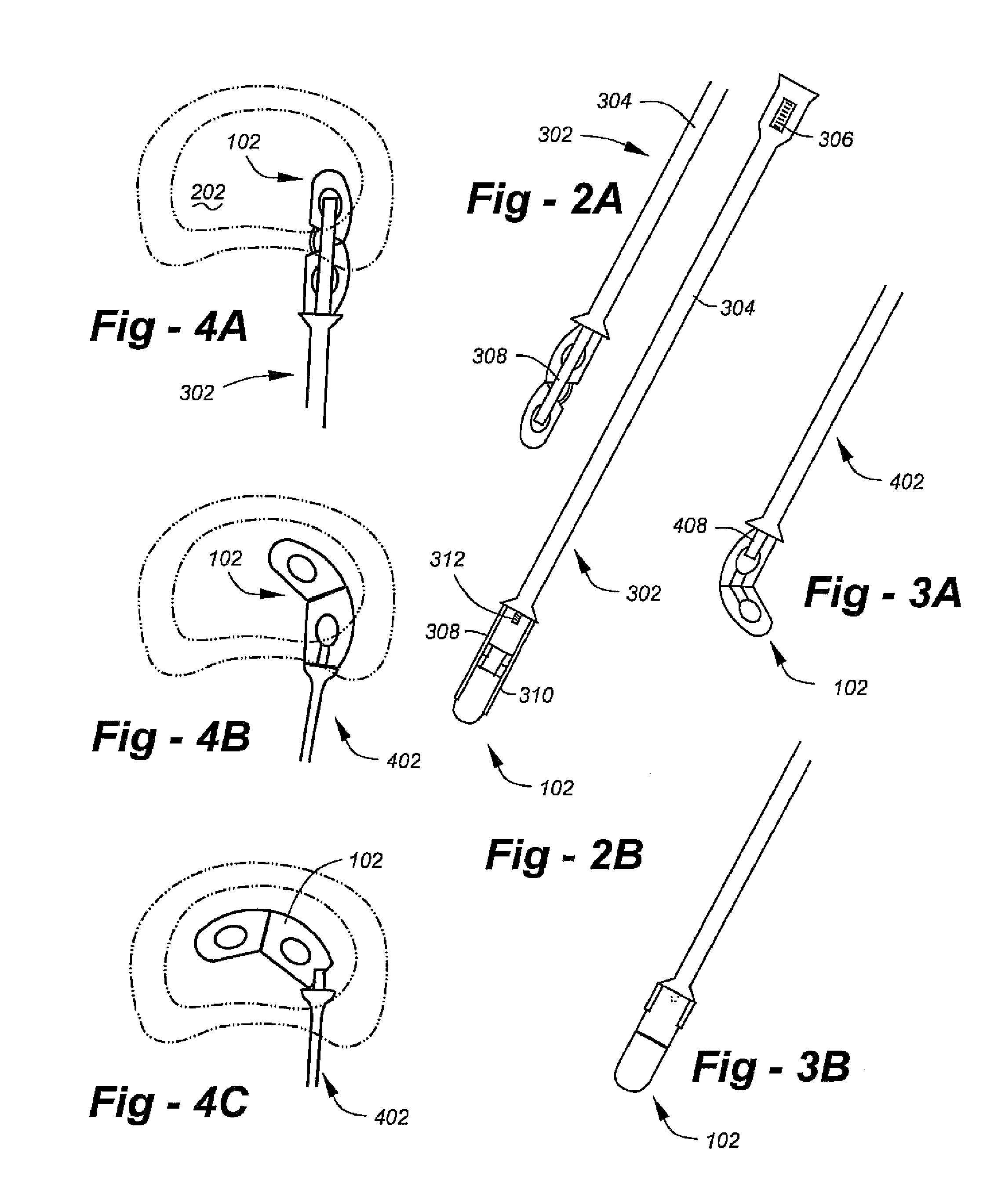 Steerable interbody fusion cage