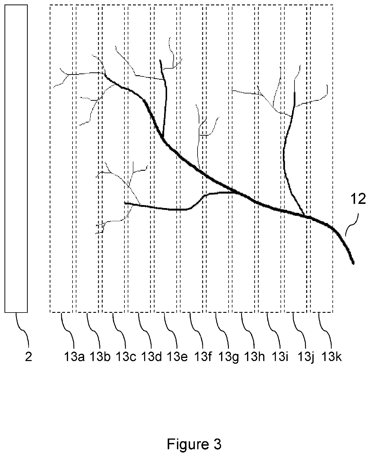 Ultrasound blood-flow monitoring