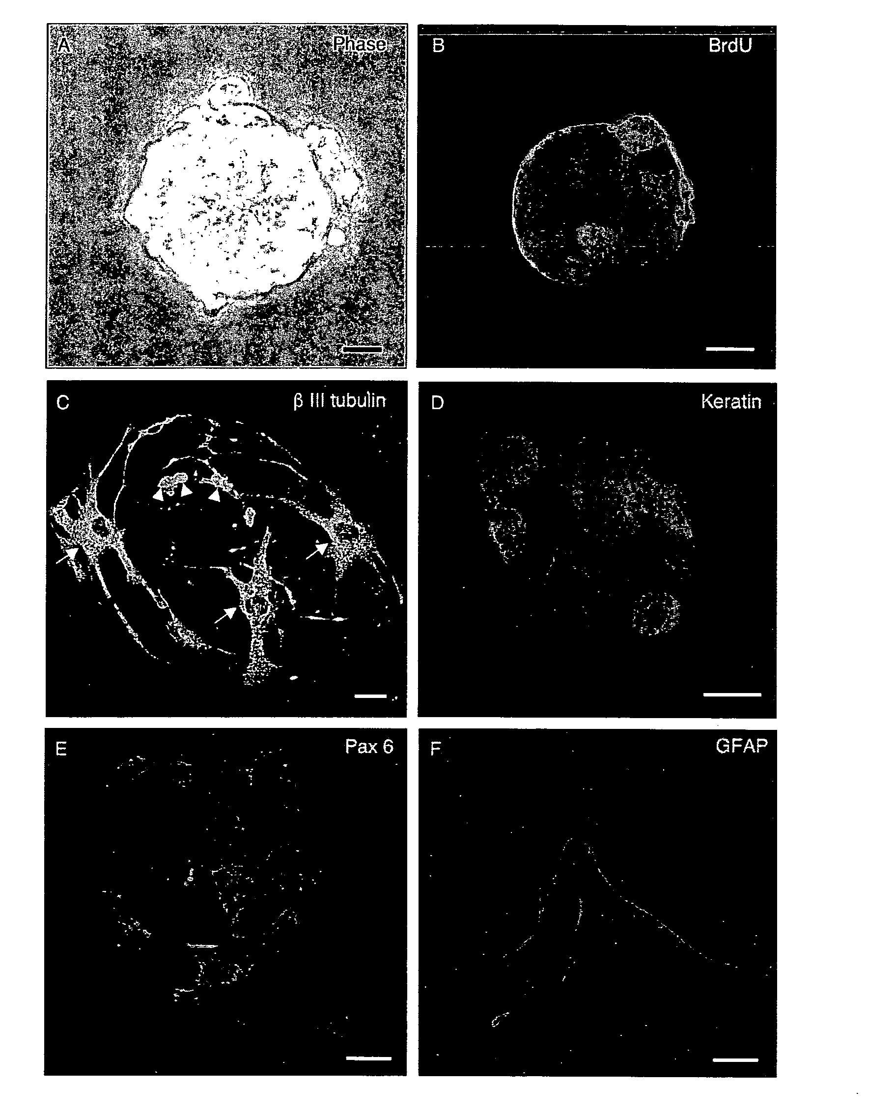 Method of treating hearing loss