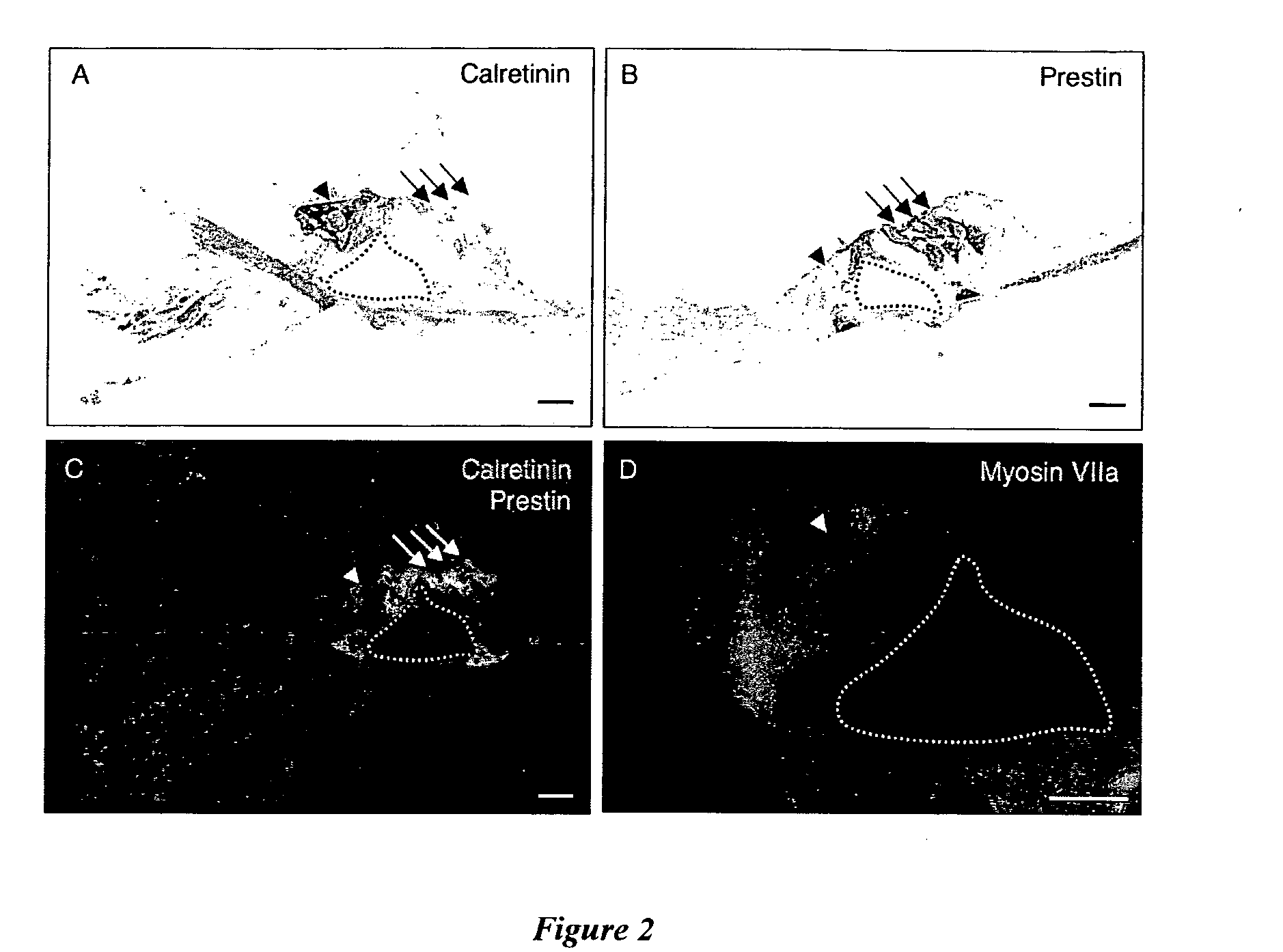 Method of treating hearing loss