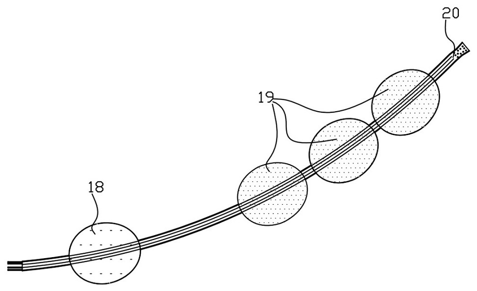 Eccentric multi-cavity smooth type rectum high-pressure high-capacity pelvis compression water bag and using method thereof