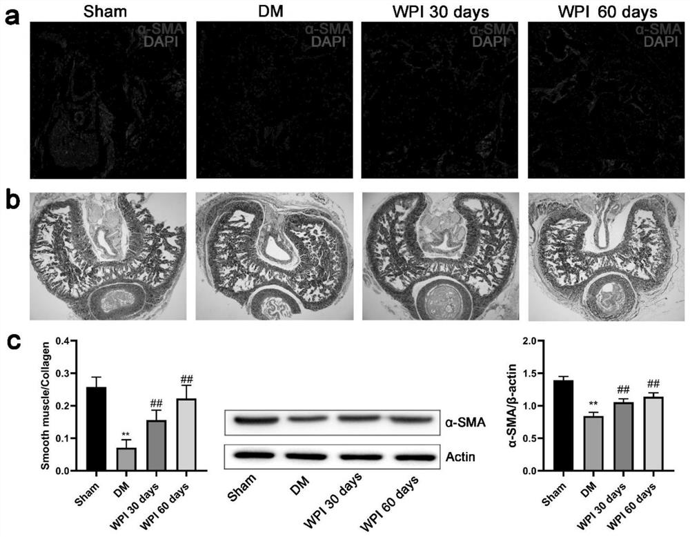 Application of cr-wpi in the treatment of erectile dysfunction