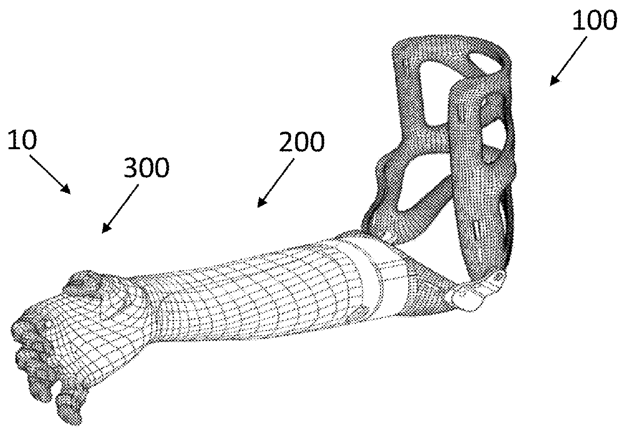 Prosthetic Arm With Adaptive Grip