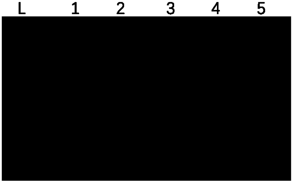 Sequence composition and kit for detecting mutation of human EGFR gene