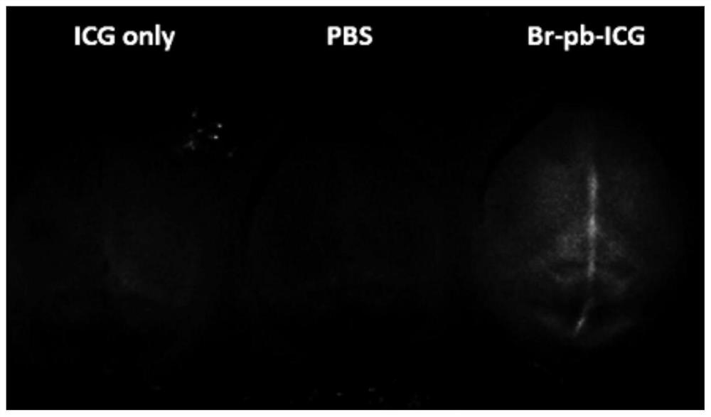 Polypeptide crossing blood-brain barrier as well as derivative and application thereof