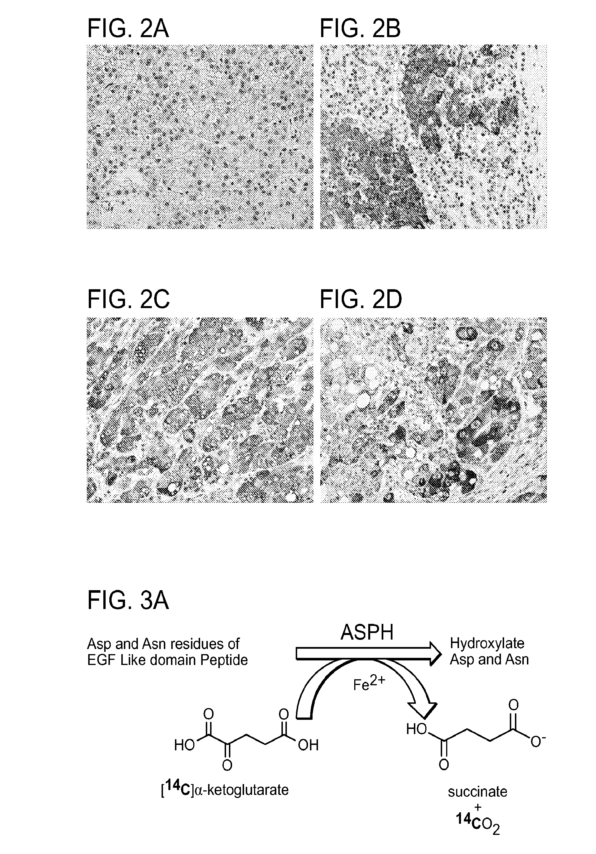 Inhibitors of Beta-Hydroxylase for Treatment of Cancer