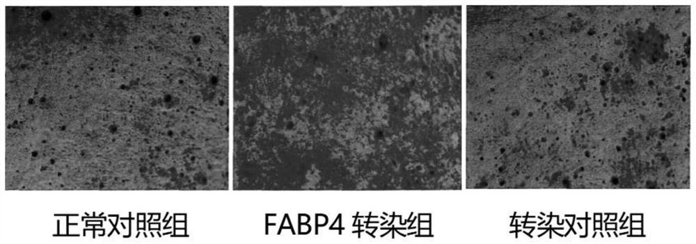 Application of FABP4 in promoting proliferation and osteogenic differentiation of mesenchymal stem cells