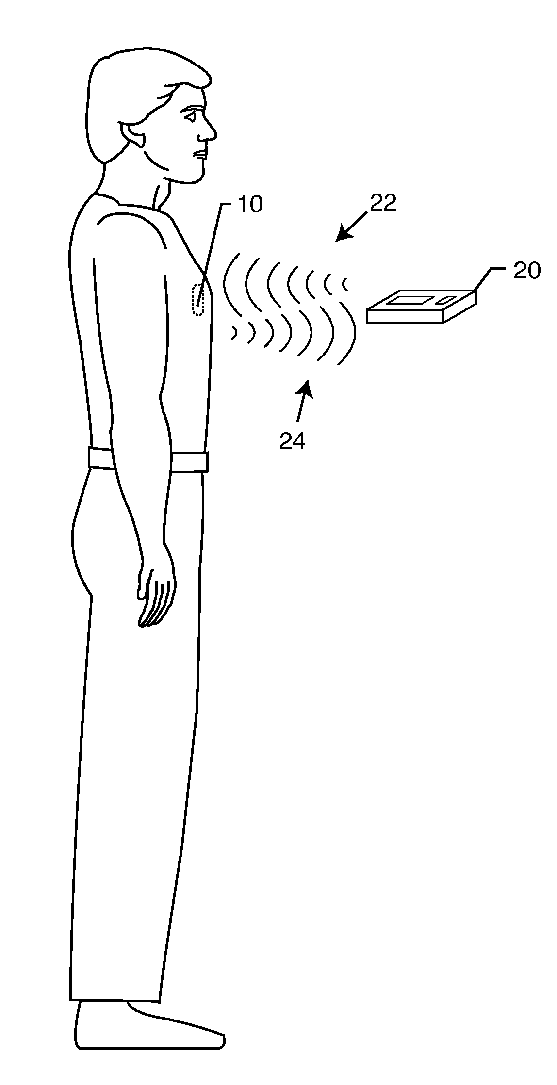 Hermetically sealed RFID microelectronic chip connected to a biocompatible RFID antenna